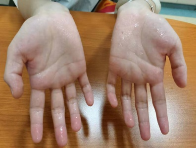 一玩手机游戏手心就出汗-手机游戏玩家为何手心出汗？揭秘与生理反应的神秘联系