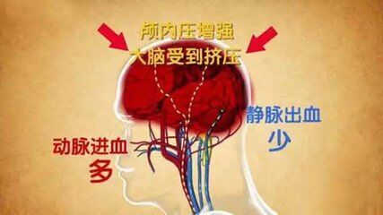 鸣回事玩手机中耳游戏没声音_玩手机耳鸣怎么办_玩手机游戏中耳鸣怎么回事