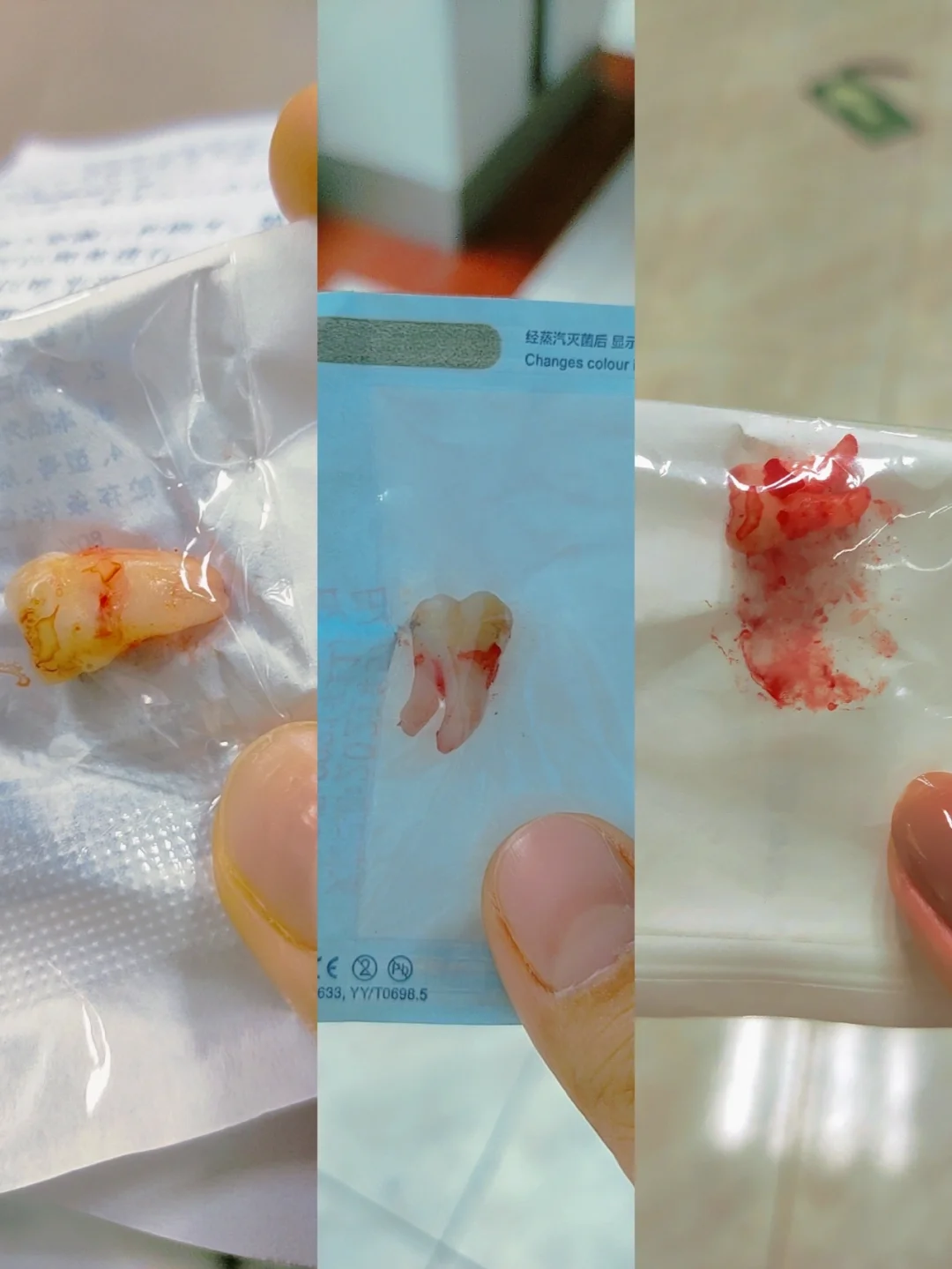 《智齿》港片资源_智齿港剧_港片智齿百度网盘