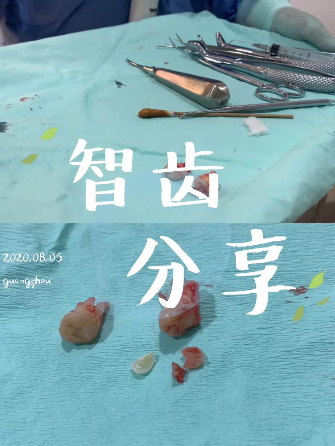 智齿港剧_《智齿》港片资源_港片智齿百度网盘