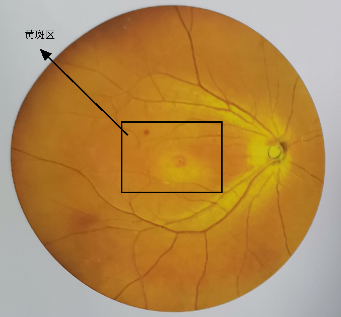 眼睛玩手机玩红了怎么办_玩手机玩的眼红了有事吗_玩手机游戏为什么会眼睛红