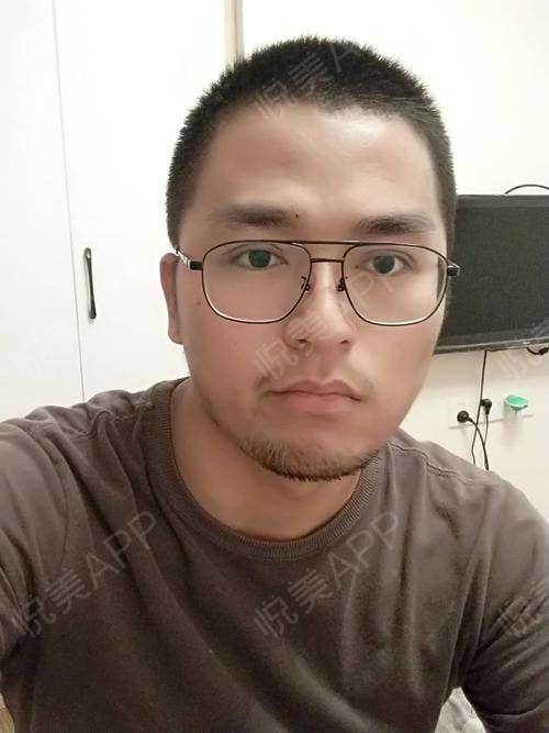 打完游戏眼睛